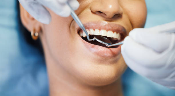 Best Teeth Whitening  in Webster City, IA
